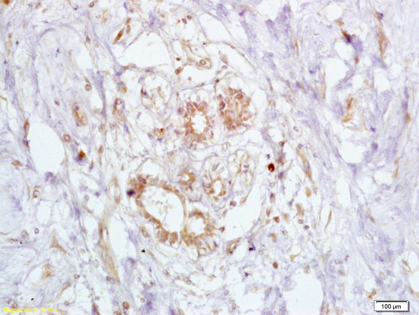 BRCA2 Rabbit pAb(bs-1210R)-50u