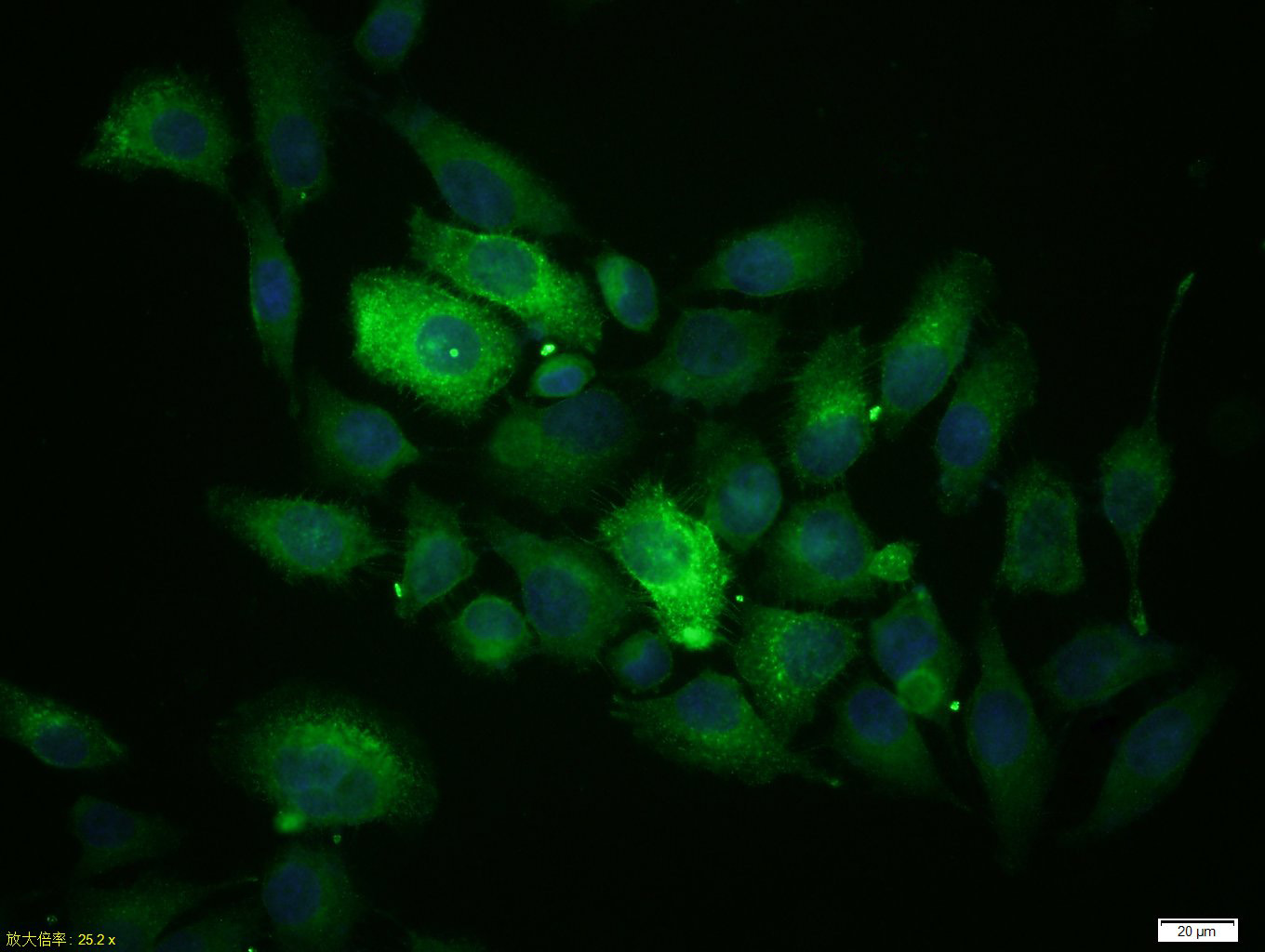 MUC1 Rabbit pAb(bs-1497R)-50ul
