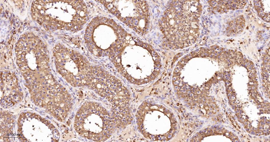 LDHA Rabbit pAb(bs-34202R)-50u