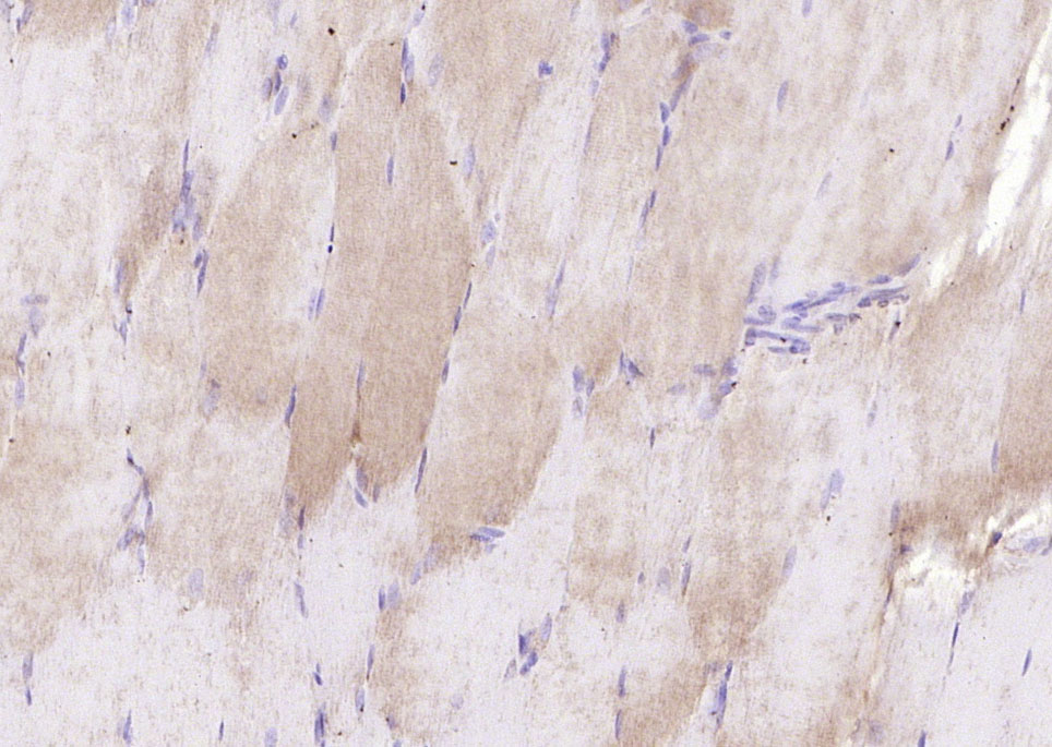 TNMD Rabbit pAb(bs-7525R)-50ul