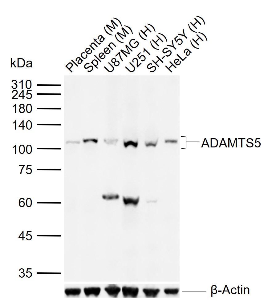 ADAMTS5 Rabbit pAb(bs-3573R)-5