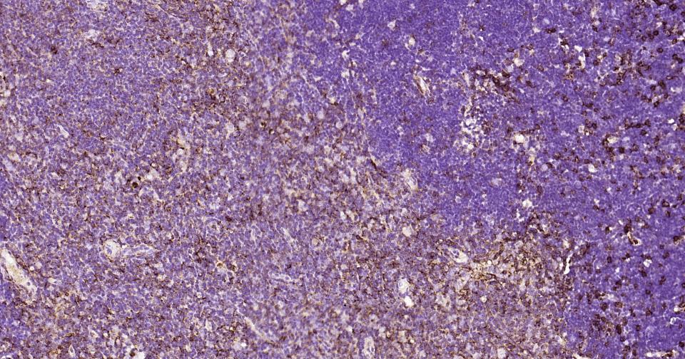 CD44 Recombinant Rabbit mAb(bs