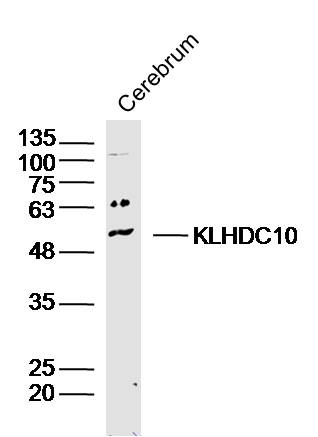 KLHDC10 Rabbit pAb(bs-16757R)-