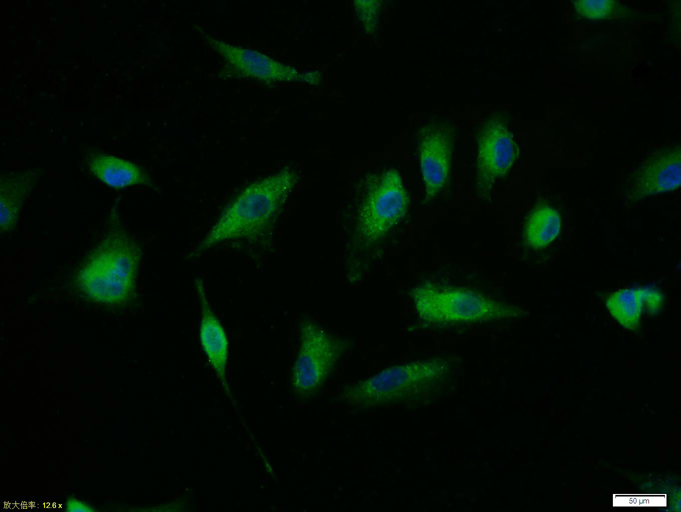 phospho-TERT (Ser1125) Rabbit 