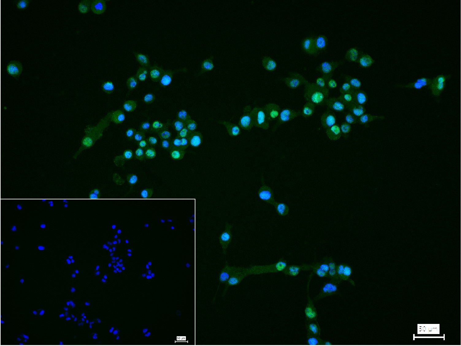 KDM4B Recombinant Rabbit mAb(b