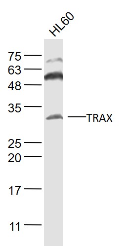 TRAX Rabbit pAb(bs-16708R)-50u