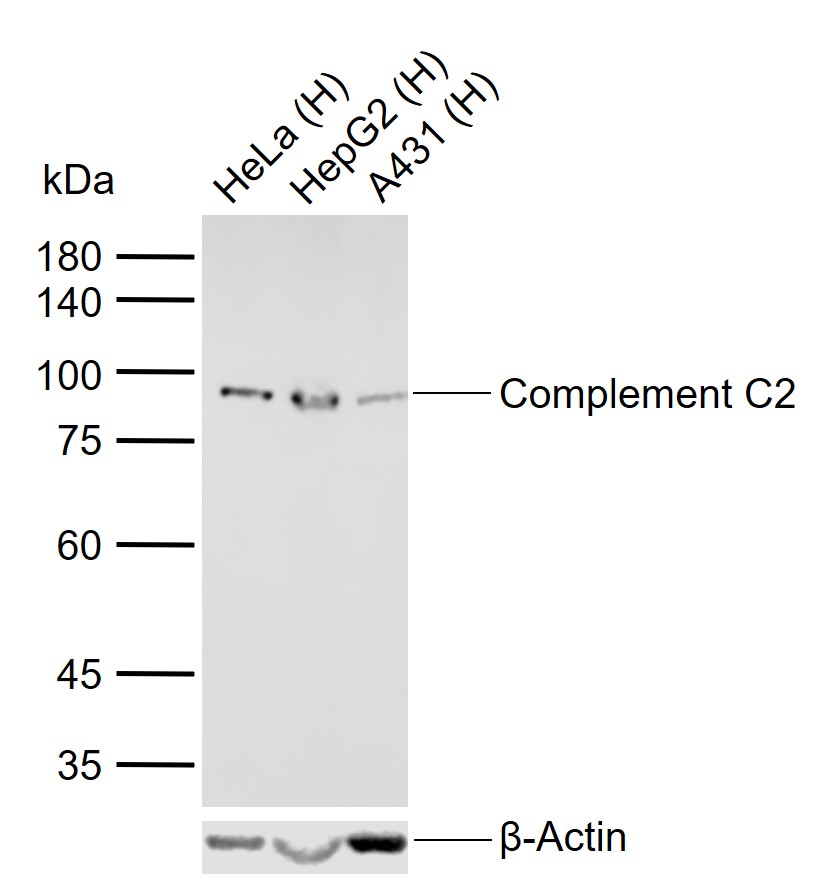 Complement C2 Rabbit pAb(bs-86