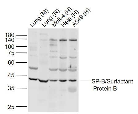 SP-B/Surfactant Protein B Rabb