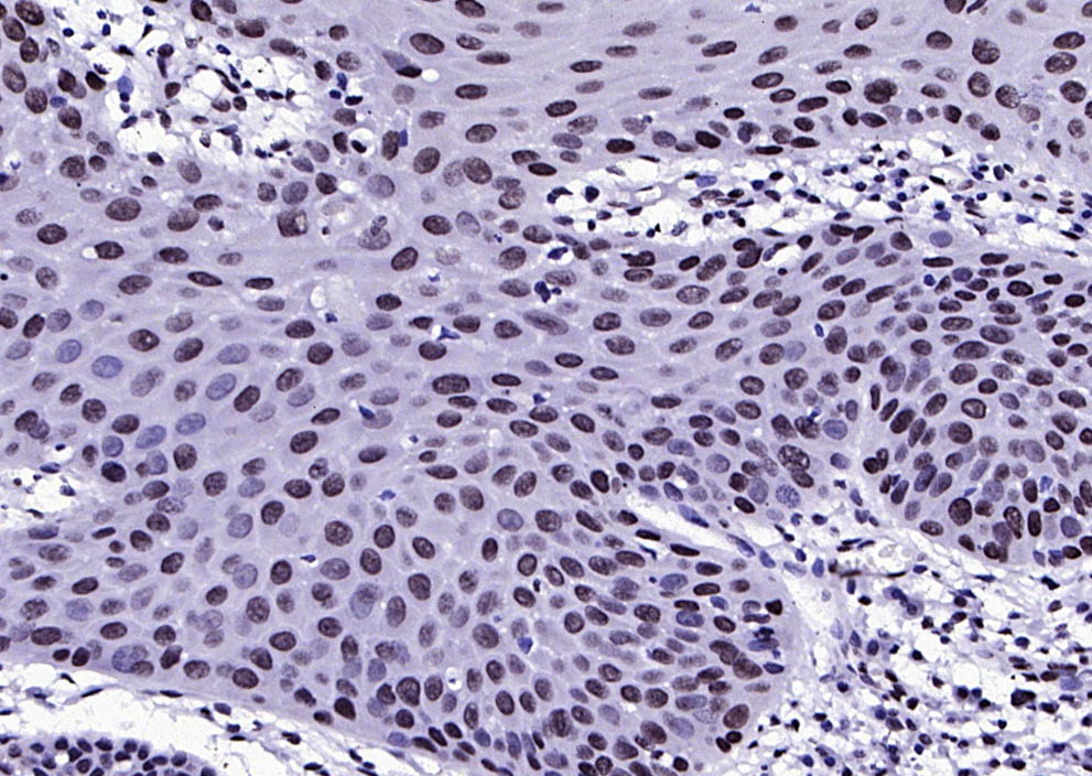 phospho-FGFR1 (Tyr307) Rabbit 