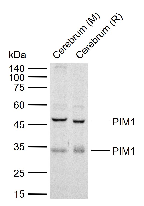 PIM1+PIM3 Rabbit pAb(bs-10305R