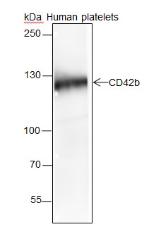 GP1BA Recombinant Rabbit mAb(b