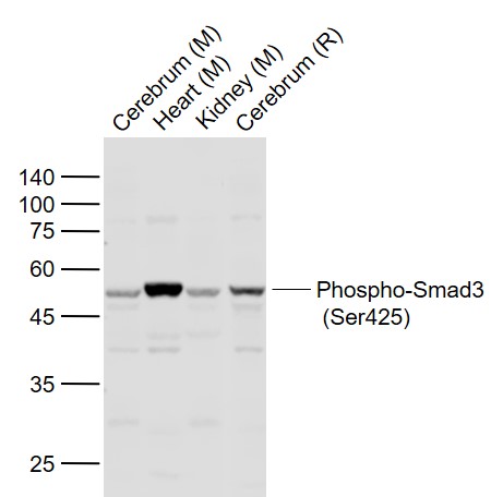 phospho-Smad3 (Ser425) Rabbit 