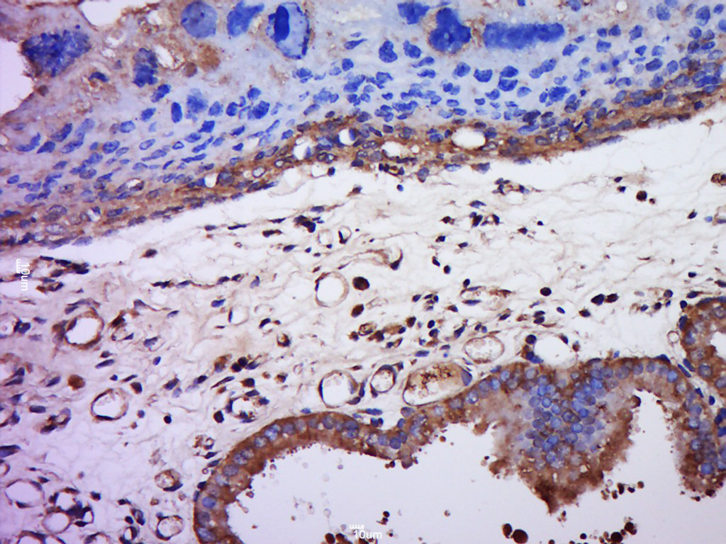 ZP2 Rabbit pAb(bs-20812R)-50ul