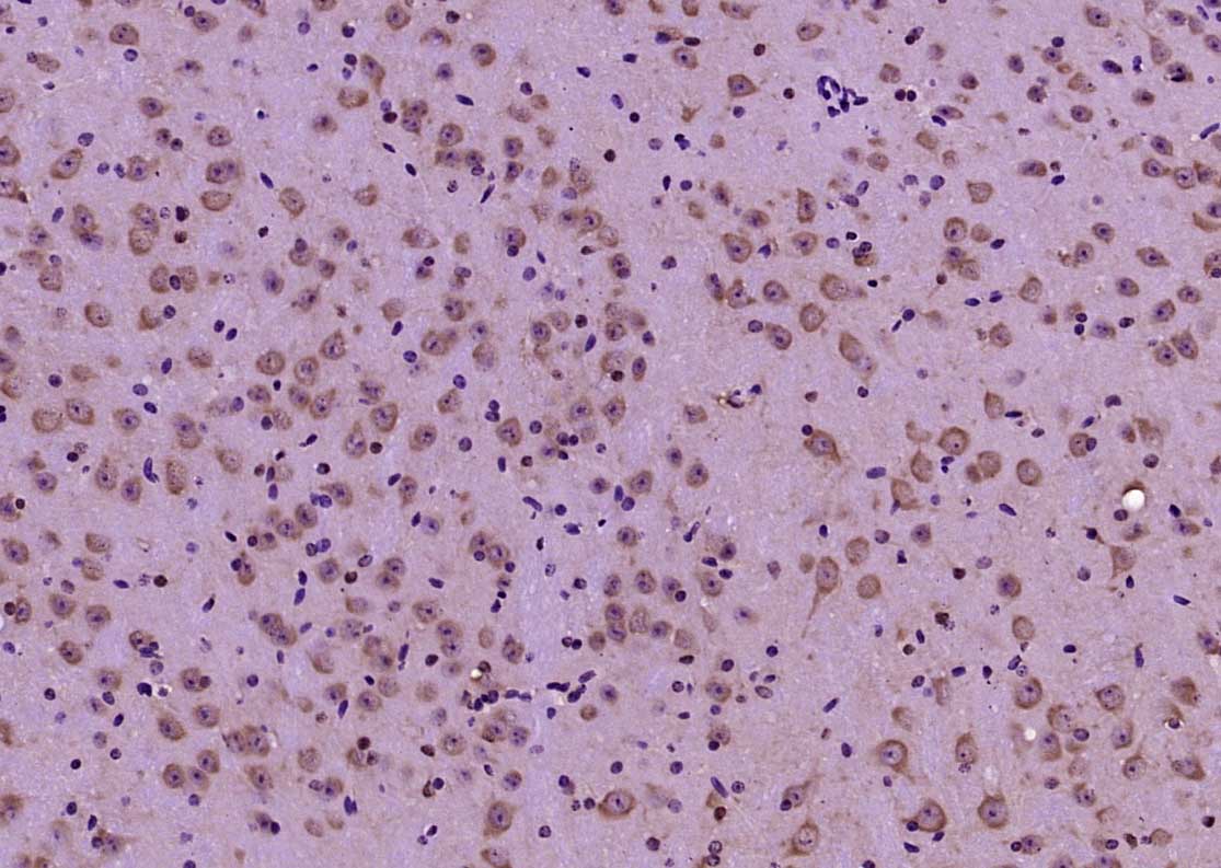 LKB1 Rabbit pAb(bs-3948R)-50ul