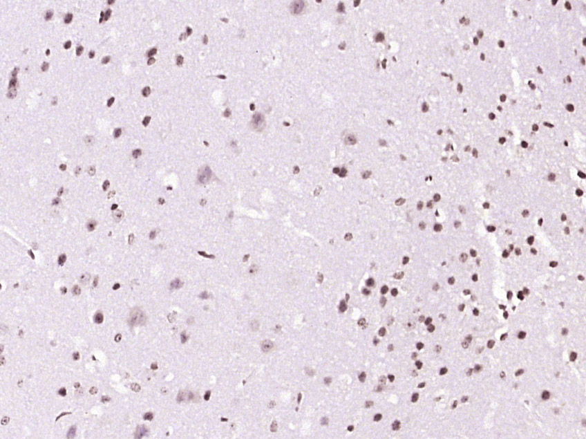 phospho-BTK (Tyr223) Rabbit pA