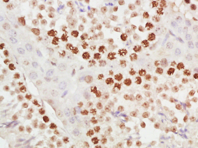 METTL11A Rabbit pAb(bs-6057R)-