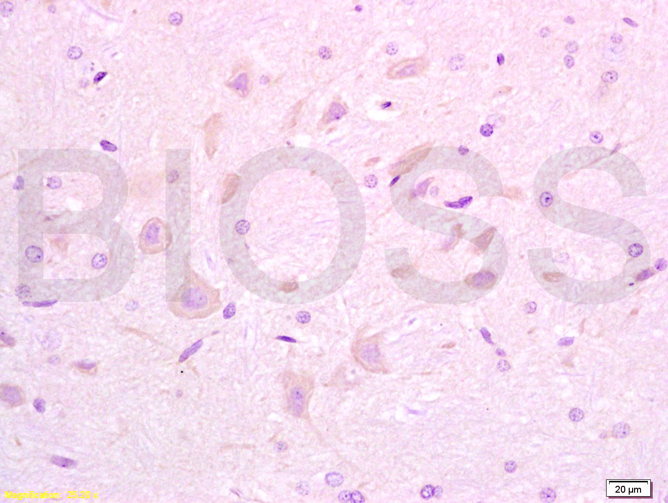 NMDAR2C Rabbit pAb(bs-0323R)-5