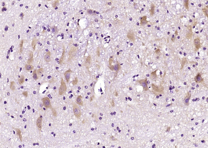 Tropomodulin 2 Rabbit pAb(bs-1
