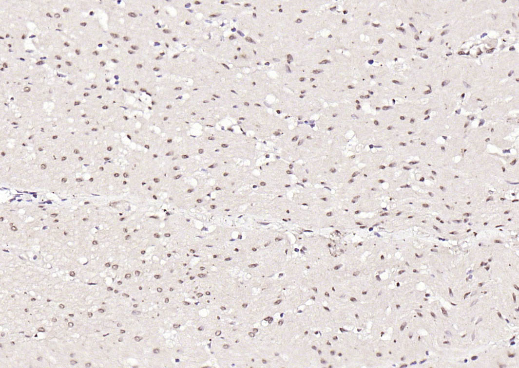 SGK1 Rabbit pAb(bs-4904R)-50ul