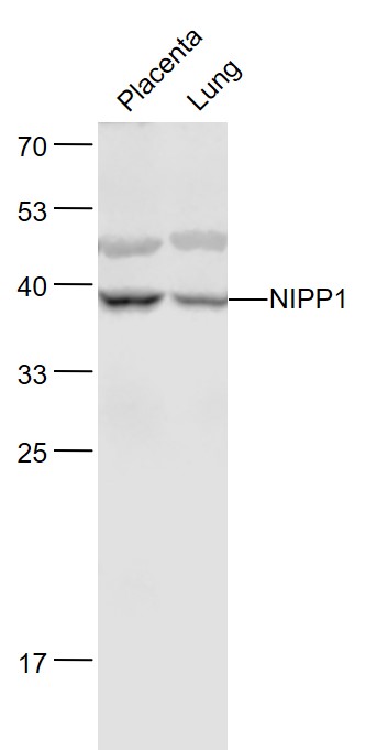 NIPP1 Rabbit pAb(bs-3658R)-50u
