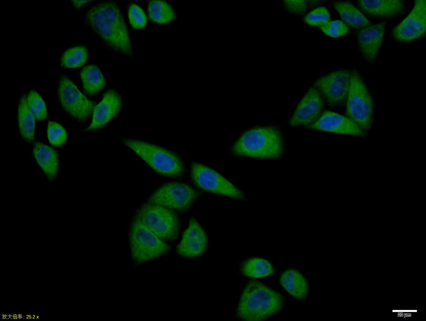 PTPN1 Rabbit pAb(bs-0182R)-50u