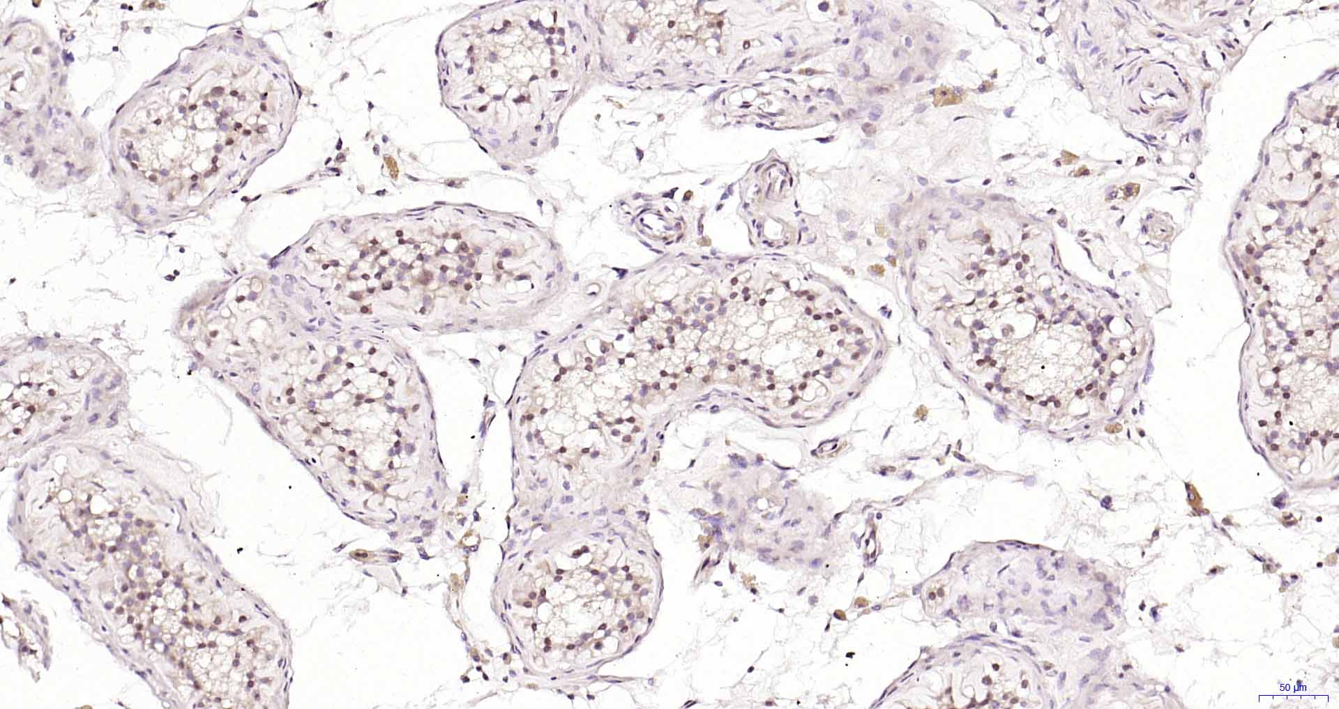 Exonuclease 1 Rabbit pAb(bs-13