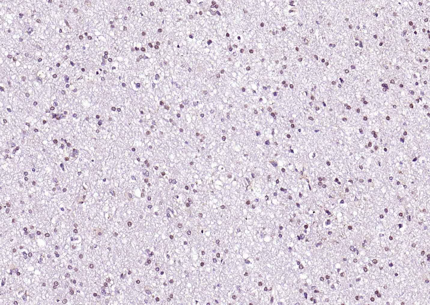 RARB Rabbit pAb(bs-0516R)-50ul