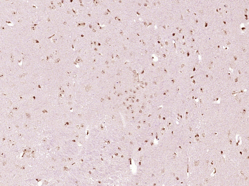 MEPCE Rabbit pAb(bs-18788R)-50