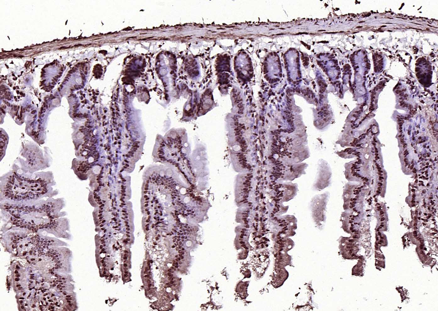 AMIGO2 Rabbit pAb(bs-11450R)-5