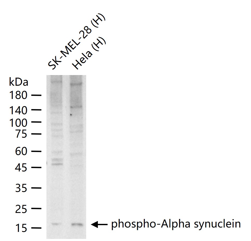 phospho-Alpha synuclein (Ser12