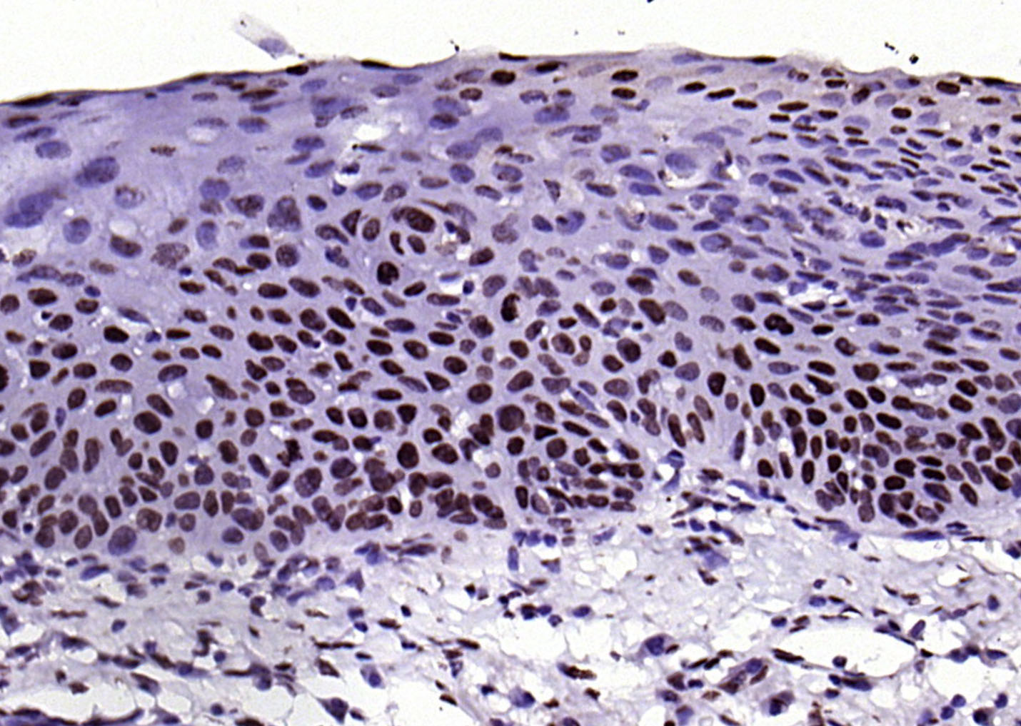 phospho-FGFR1 (Tyr307) Rabbit 