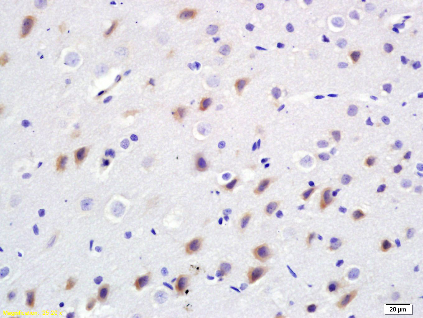 BDKRB2 Rabbit pAb(bs-2422R)-50