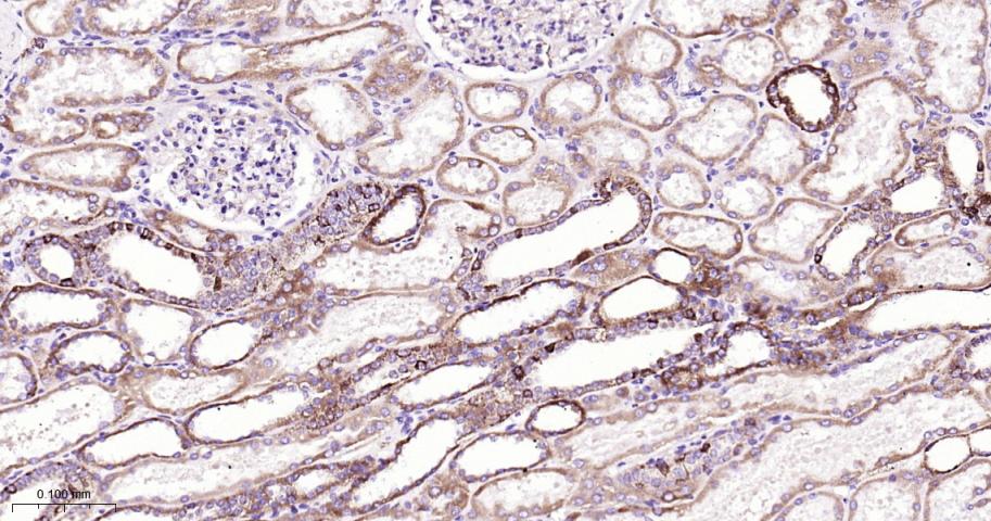 CPT1A Rabbit pAb(bs-2047R)-50u