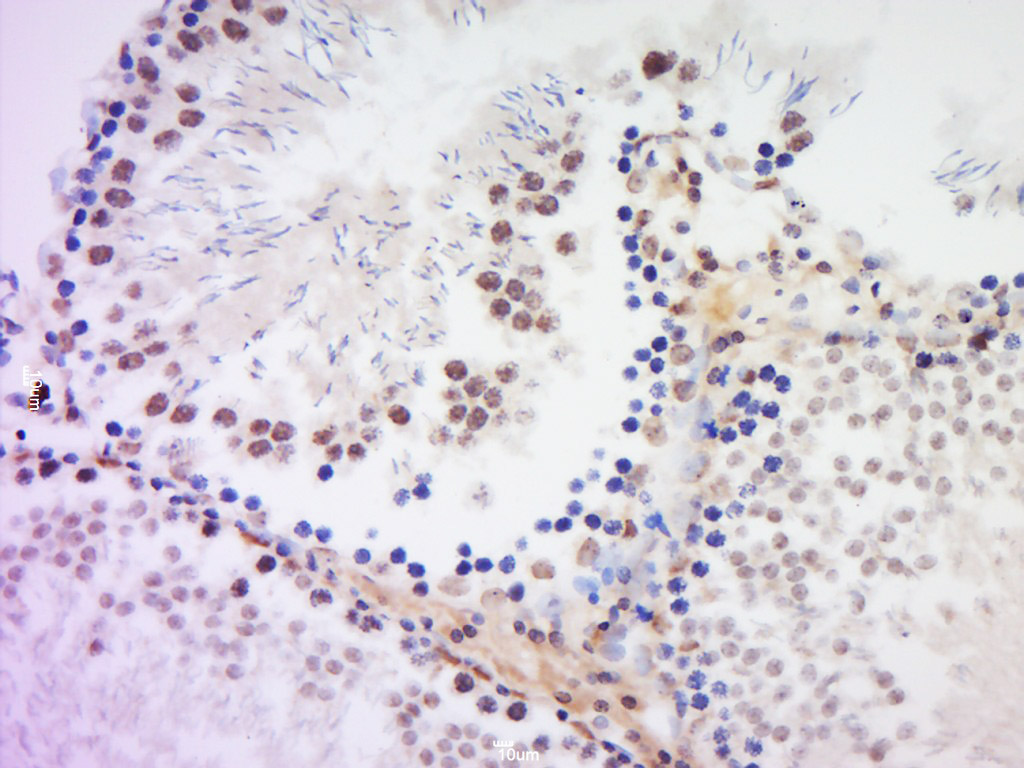 HSH2D Rabbit pAb(bs-13643R)-50