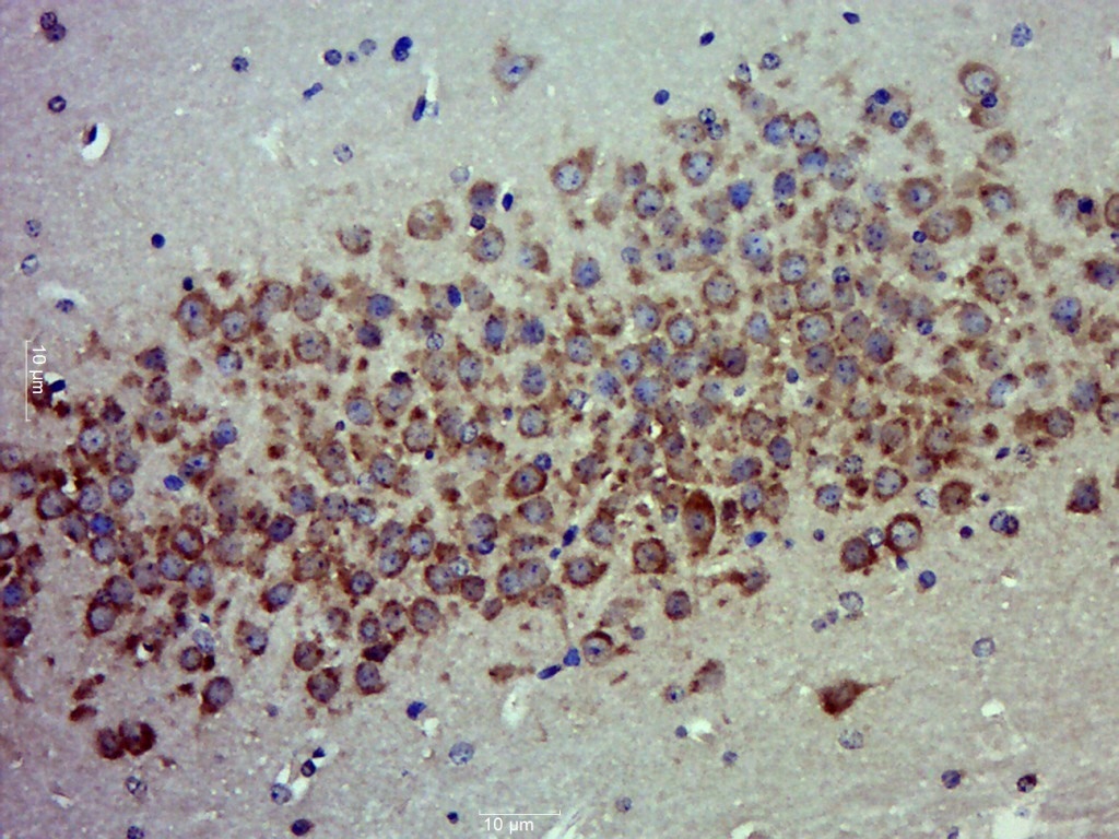 MOB4A Rabbit pAb(bs-17698R)-50