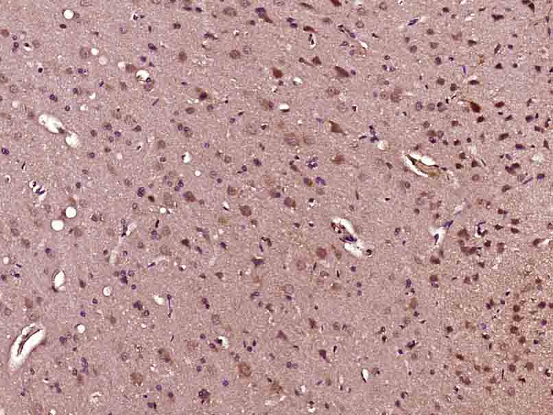 CCNG2 Rabbit pAb(bs-3822R)-50u