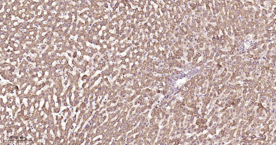 SDHB Recombinant Rabbit mAb(bs