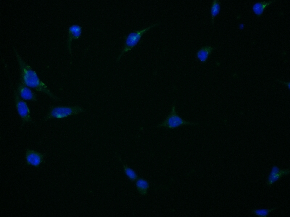 B3GAT1 Rabbit pAb(bs-1635R)-50