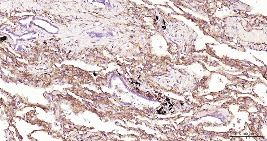 ICAM1 Rabbit pAb(bs-0608R)-50u