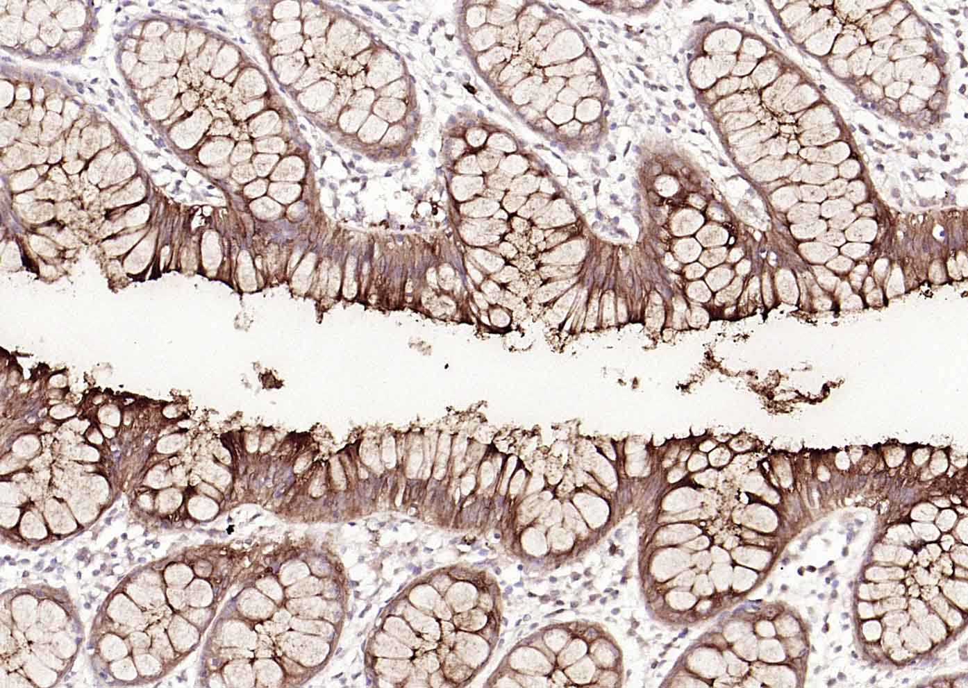 CEACAM5 Mouse mAb(bsm-43141M)-