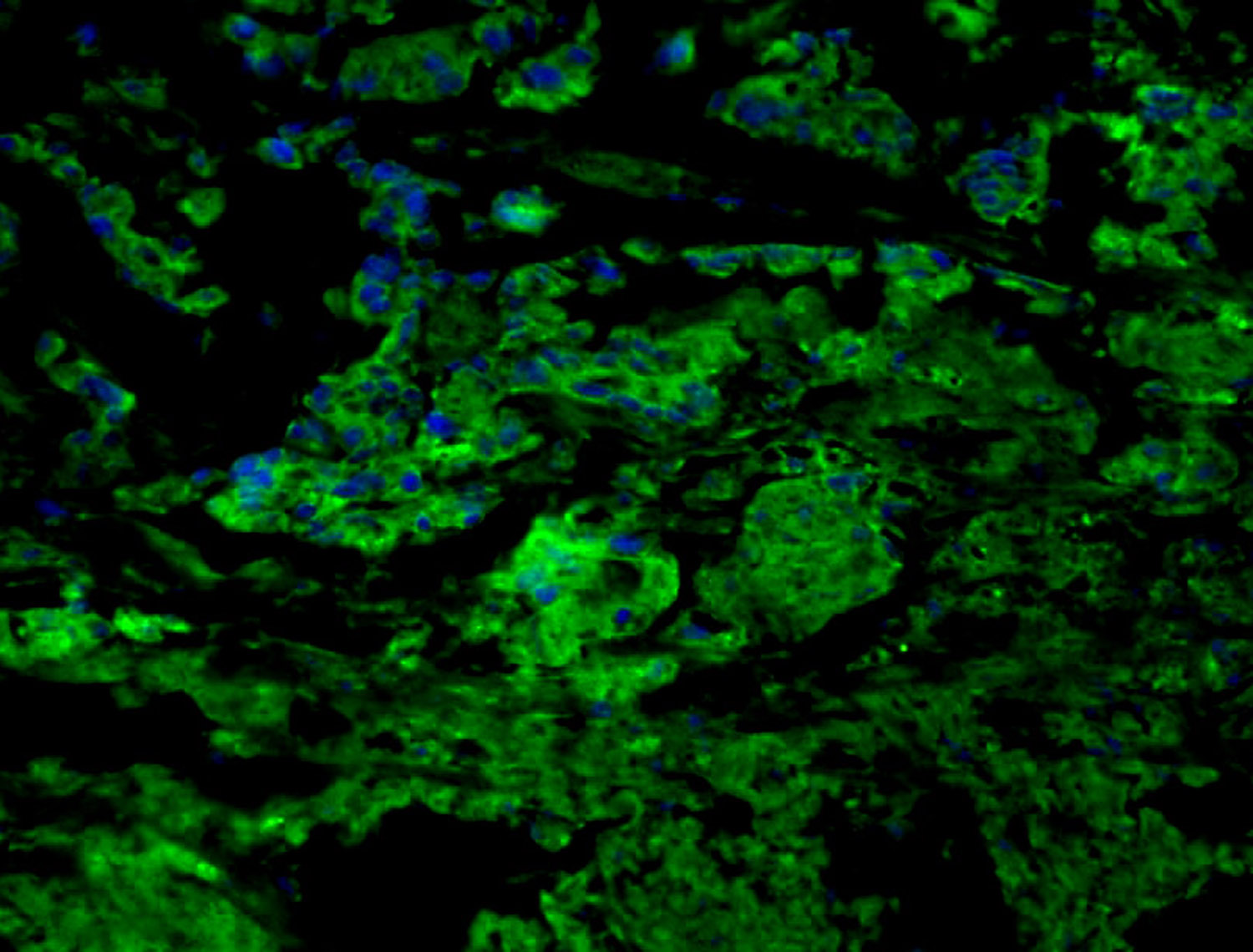 CCR7 Rabbit pAb(bs-1305R)-50ul