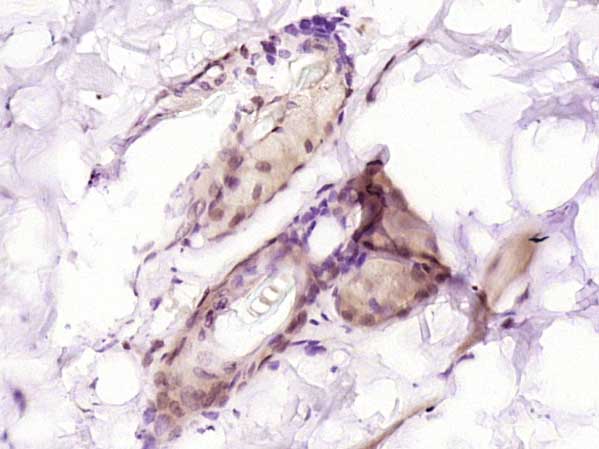 TCF7L1 Rabbit pAb(bs-12891R)-5