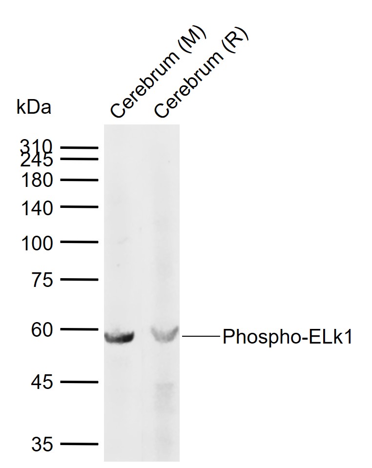 phospho-ELk1 (Ser389) Rabbit p