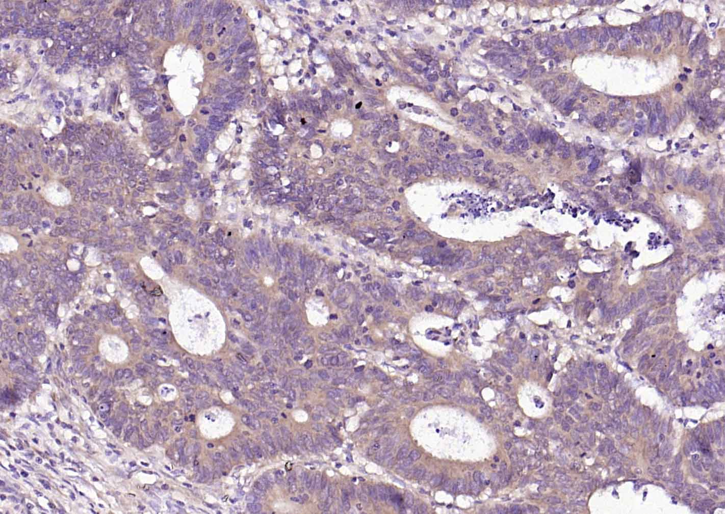 P4HB Recombinant Mouse mAb(bsm