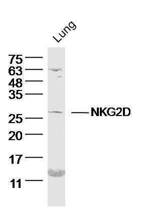 NKG2D Rabbit pAb(bs-0938R)-50u