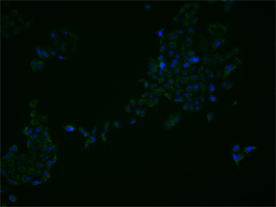 ASPP2 Rabbit pAb(bs-1283R)-50u