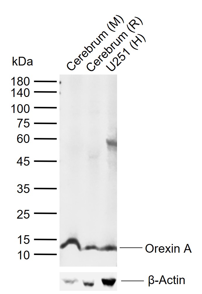 Orexin A Rabbit pAb(bs-15509R)