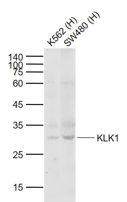 KLK1 Rabbit pAb(bs-1963R)-50ul