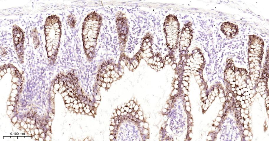 AGR2 Recombinant Rabbit mAb(bs