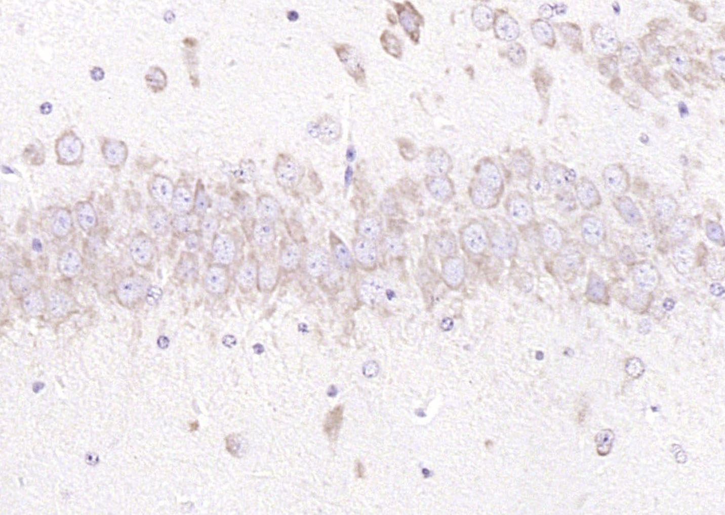 GRP94 Rabbit pAb(bs-0194R)-50u